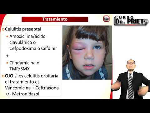 Vídeo: La cel·lulitis preseptal és dolorosa?