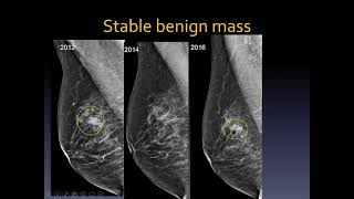 Mammography interpretation