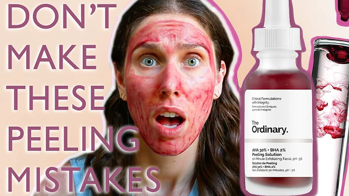 CHEMICAL PEELS: How To Prepare Your Skin For The o...