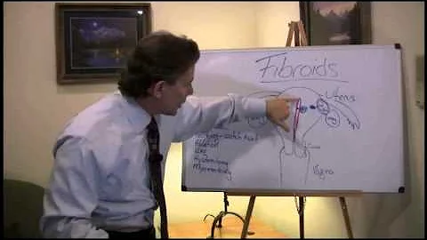 Fibroids with Dr. Gregory Davis