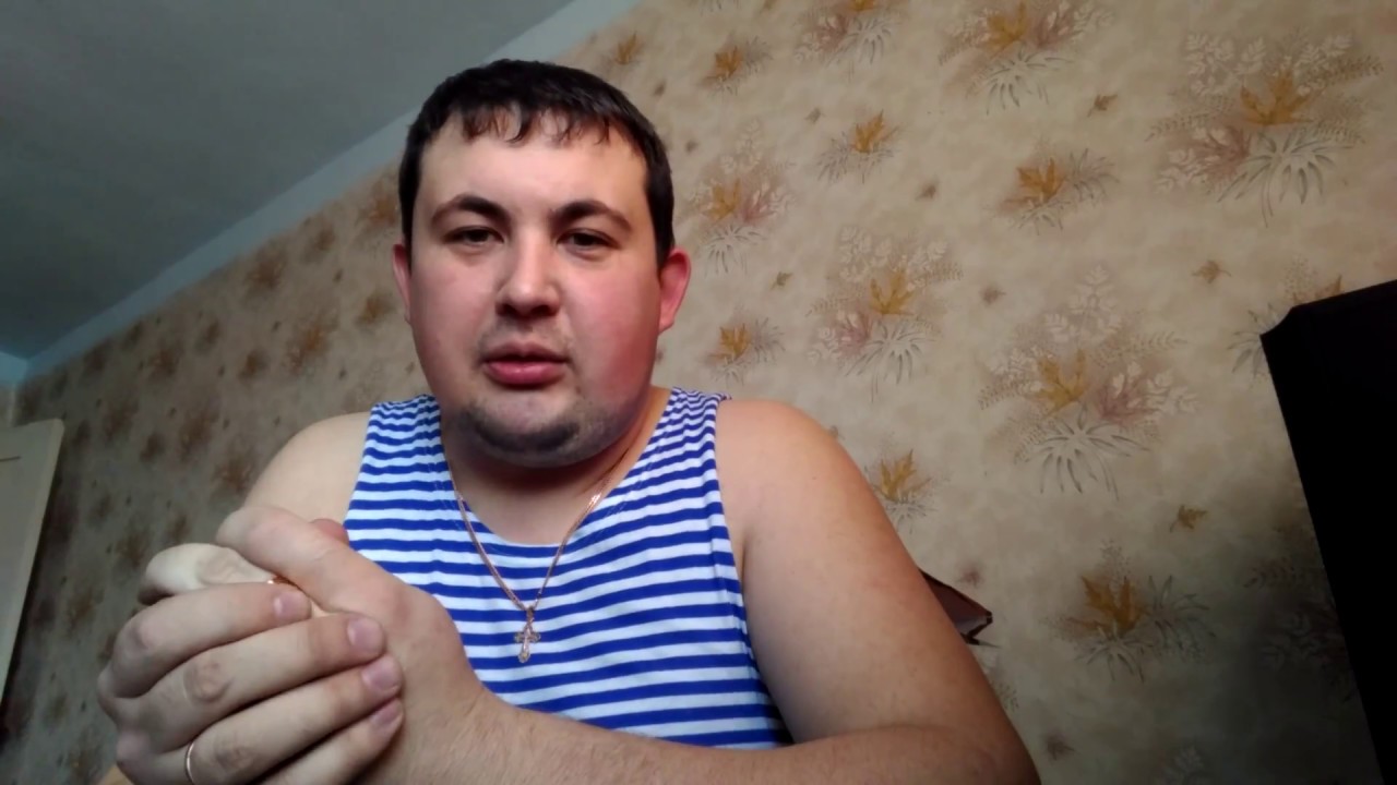 Перелом вертлужной впадины на моем примере - YouTube