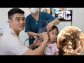 💫耳かき | 耳掃除 | 最初、その少女は耳を診てもらうのがとても怖かった。