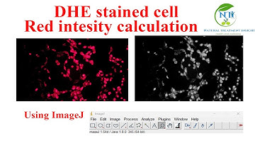 How to Analyze DHE Red Fluorescence in ImageJ | Oxidative Stress Marker Quantification