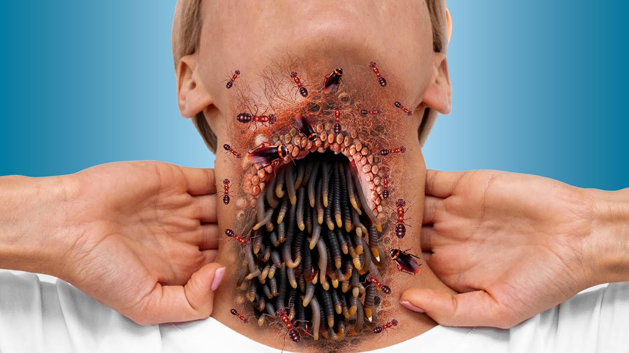 Deep Cleaning Animation - ASMR Removing Ticks, Maggots and insects from Neck