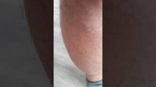 20160910 090914