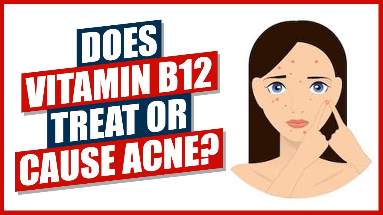 Does Vitamin B12 Treat Or Cause Acne YouTube