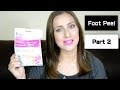 Softsole Express | Foot Peel - Part 2