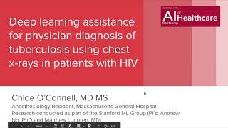 Deep learning assistance for physician diagnosis of TB using chest x-rays in patients with HIV
