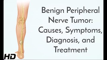 Benign Peripheral Nerve Tumor: Causes, Symptoms, Diagnosis and Treatment