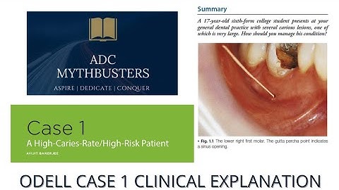 ODELL CASE 1 CLINICAL EXPLANATION | New Format ADC Part 1 | Australian Dental Council Examinations