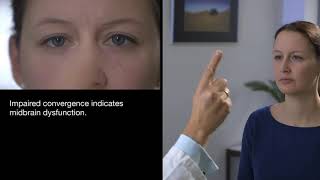 Vergence and Convergence Reaction Test   YouTube