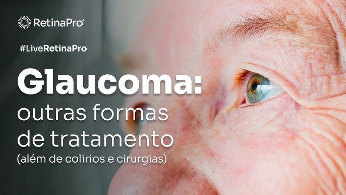 Como Funciona o Olho - Clínica de Oftamologia Macruz - Cirugias da