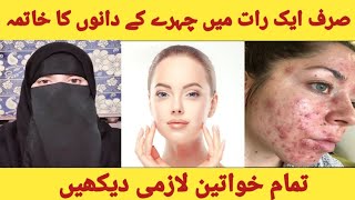 How to Remove Pimples Overnight | Remove Dark Spots and Blackheads | Acne Treatment