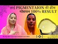 Pigmentaion 100 result  pigmentaion cream  gorapan cream  pigmentation treatment at home