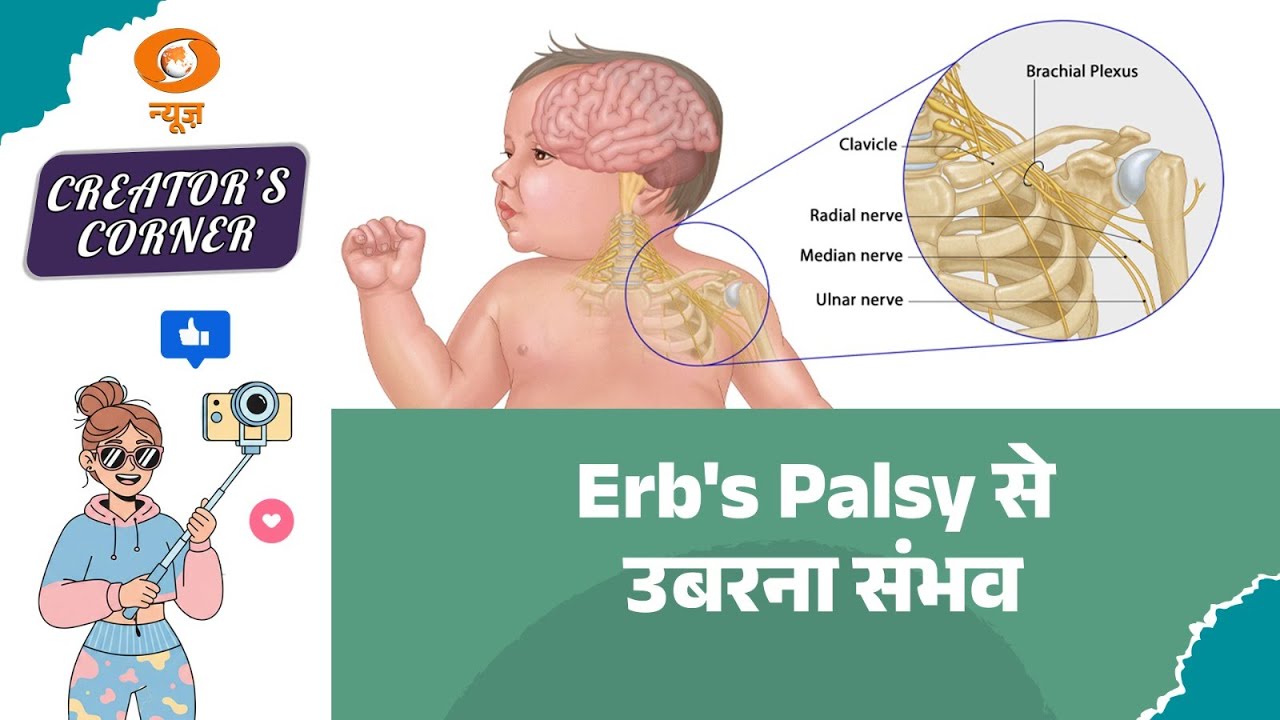 Creators Corner | Eab’s Palsy: Recovery Possible? जानें कैसे! | Health Awareness | Medical Awareness