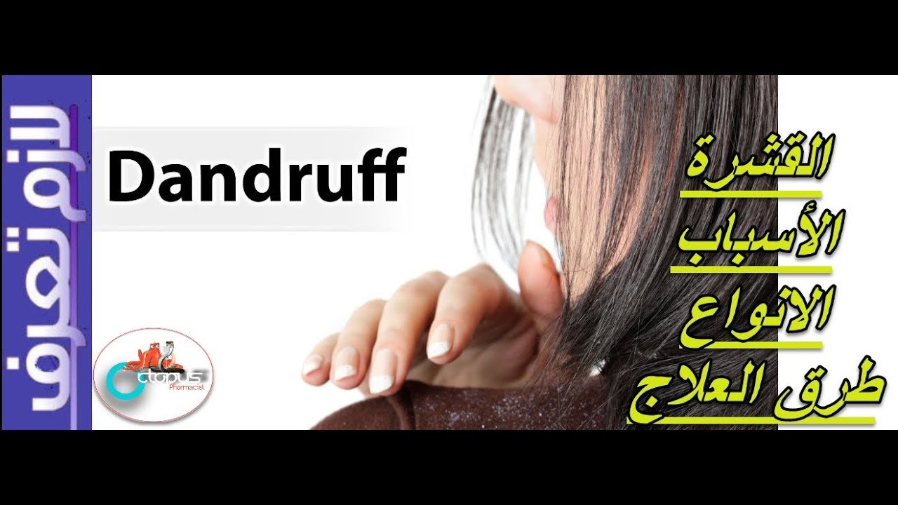 Dandruff| القشرة | الاسباب والعلاج | الانواع| الشامبوهات | قشرة المهاد| كل ثلاثاء من لازم تعرف