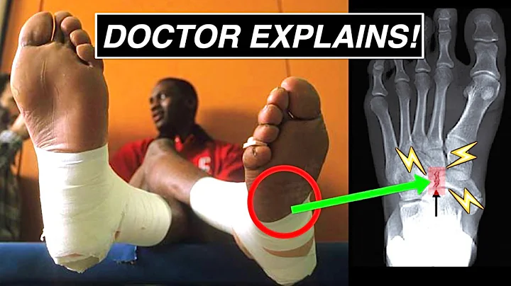 Doctor Explains Michael Jordan’s BROKEN Foot!