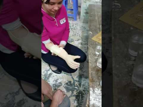 Tay giả điện tử - Tay giả điện sinh học