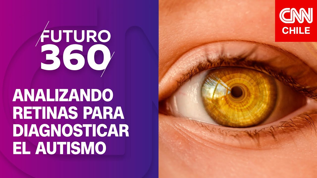 Diagnosticando el autismo a través de los ojos | Bloque científico de ...