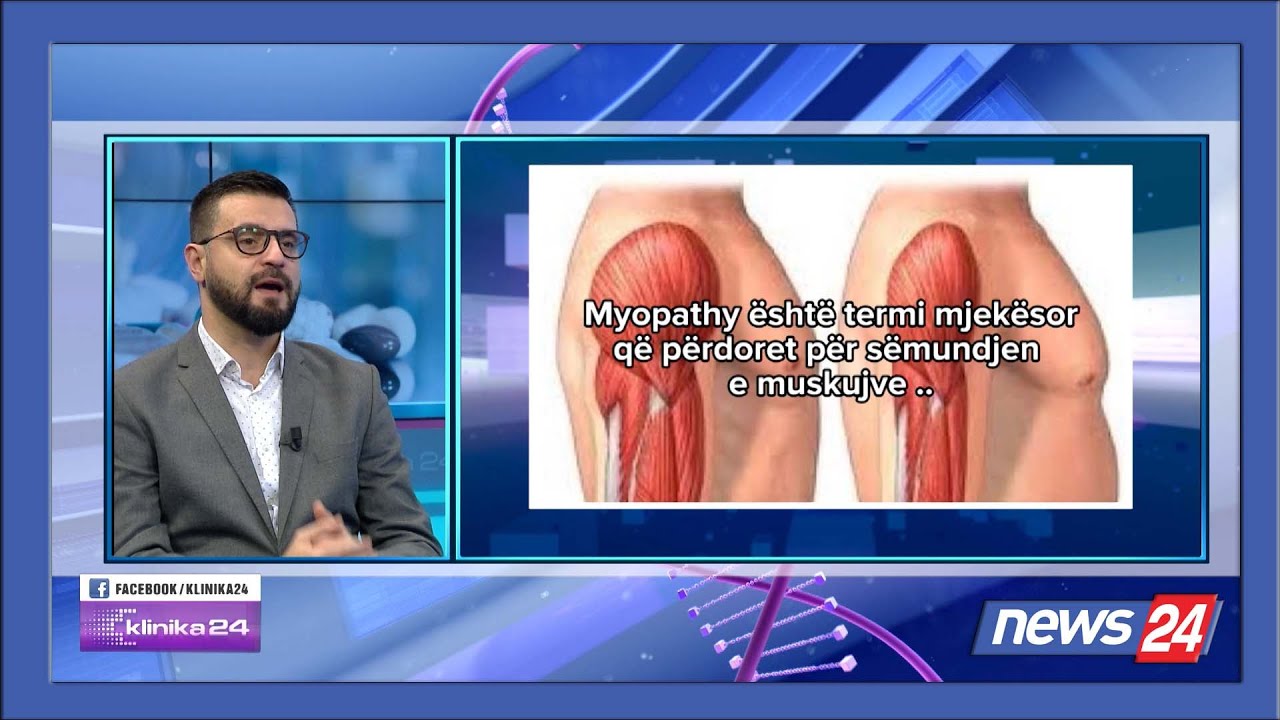 Sëmundja myopathy - çfarë është ajo? Mjeku reumatolog shpjegon se sëmundja e muskujve…