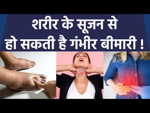 वीडियो: मुझे दो बार सूचनाएं क्यों मिलती हैं?