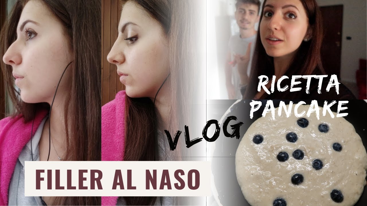 MI SONO RIFATTA IL NASO RINOFILLER La Mia Esperienza VLOG YouTube