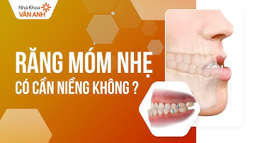 Răng móm nhẹ có cần niềng không?