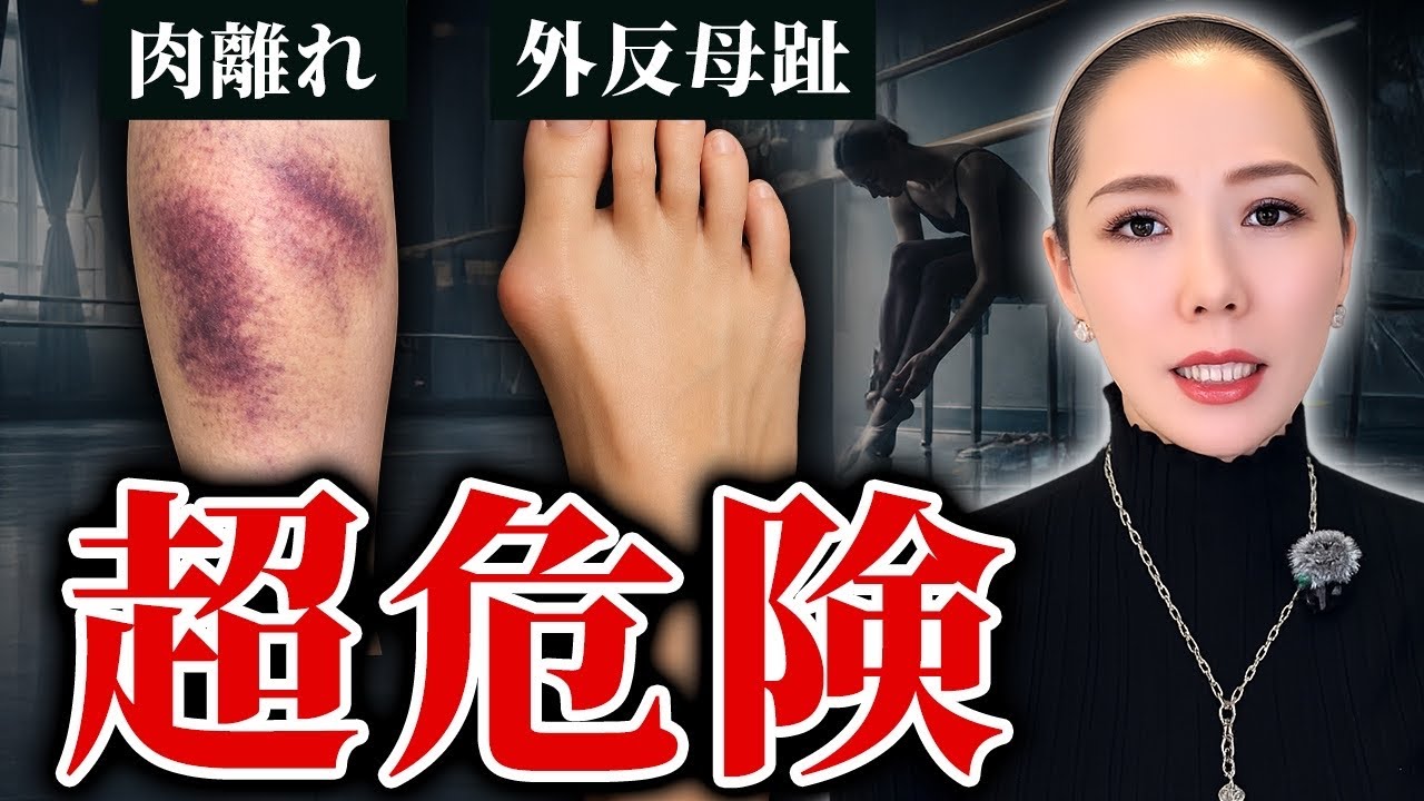 【危険】大人バレエでよくある怪我と対策を徹底解説します！