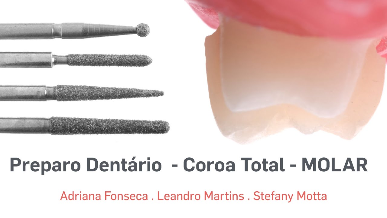 Preparo Dentário - Coroa Total -  MOLAR