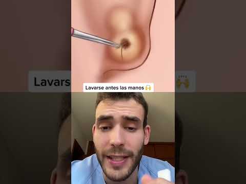 Video: Cómo curar un anillo en la nariz y cuidar las infecciones: 13 pasos