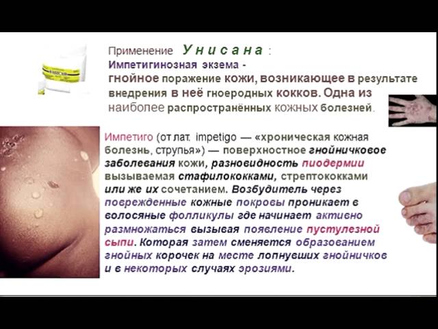 Унисан - для лечения кожи
