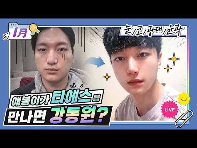 [월간티에스]신사역 성형외과 1월 성형후기 BEST4🎉찐 성형 맛집 티에스🧡 #눈성형 #코성형 #윤곽수술