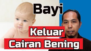 Bayi Gumoh Cairan Bening