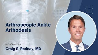 Arthroscopic Ankle Arthodesis - Craig S. Radnay, MD