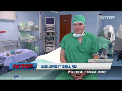 Cievna chirurgia - ANTES Plus Michalovce