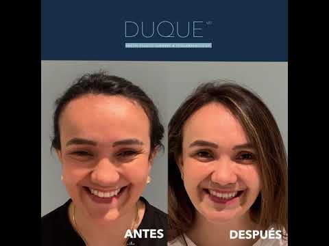 Antes y Después 7 | Dr. Jorge Duque Silva