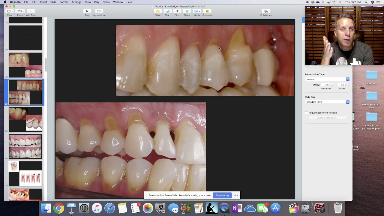 Class V Lesions. Education for dental staff. YouTube