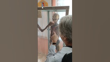 Chest and heart beat 💓 #mbbsshorts #mbbsinrussia #viral #neet2023 #shortsfeed #like #subscribers