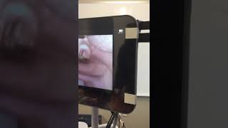 Glidescope tip for optimal intubation