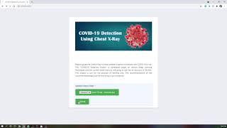 COVID 19 Detection from Chest X Rays Using Deep Learning