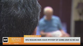 Eye on Health: Researchers solve mystery of going gray as we age