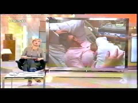 Paralisis Braquial Obstetrica Entrevista Espejo Pu...