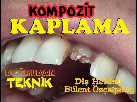 Video: Kaplamalar Nasıl Eklenir