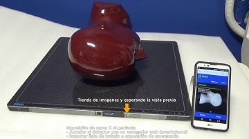 Edge Air - Storage Function(ESP)