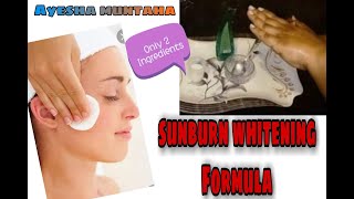 Sunburn Whitening Formula Cream Only 2 ingredients video urdu| وائٹننگ فارمولا کریم ||Ayesha Muntaha