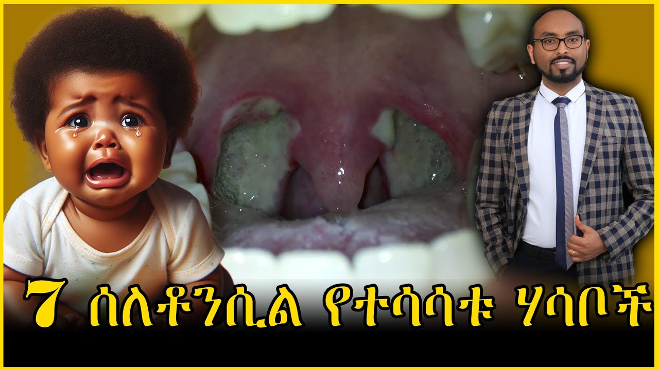 ስለ ቶንሲል ህመም የተሳሳቱ 7 አመለካከቶች |  7 Myth and facts about tonsillitis | #health #doctor #habesha