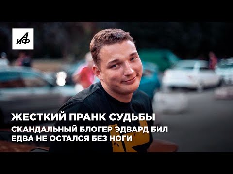 Жесткий пранк судьбы. Скандальный блогер Эдвард Бил едва не остался без ноги