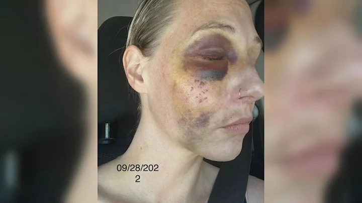 Video shows woman being taken to the ground, but p...