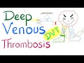 Deep Venous Thrombosis (DVT) | Pulmonary Medicine