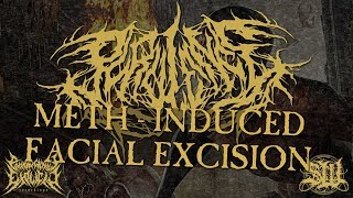 Purulence - Meth-Induced Facial Excision